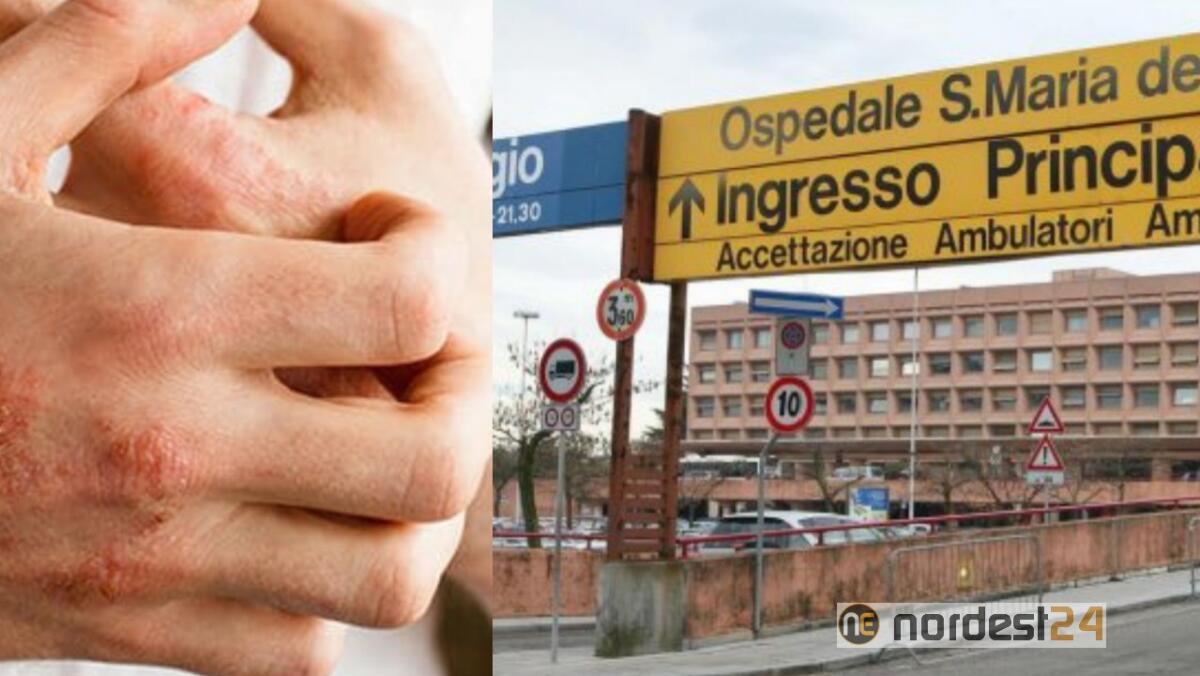 A Udine consulti dermatologici gratuiti per chi soffre di dermatite atopica - 