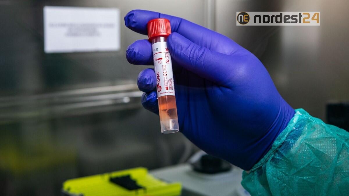 Guardian: nuovo test scopre infettati prima che contagiosi - 