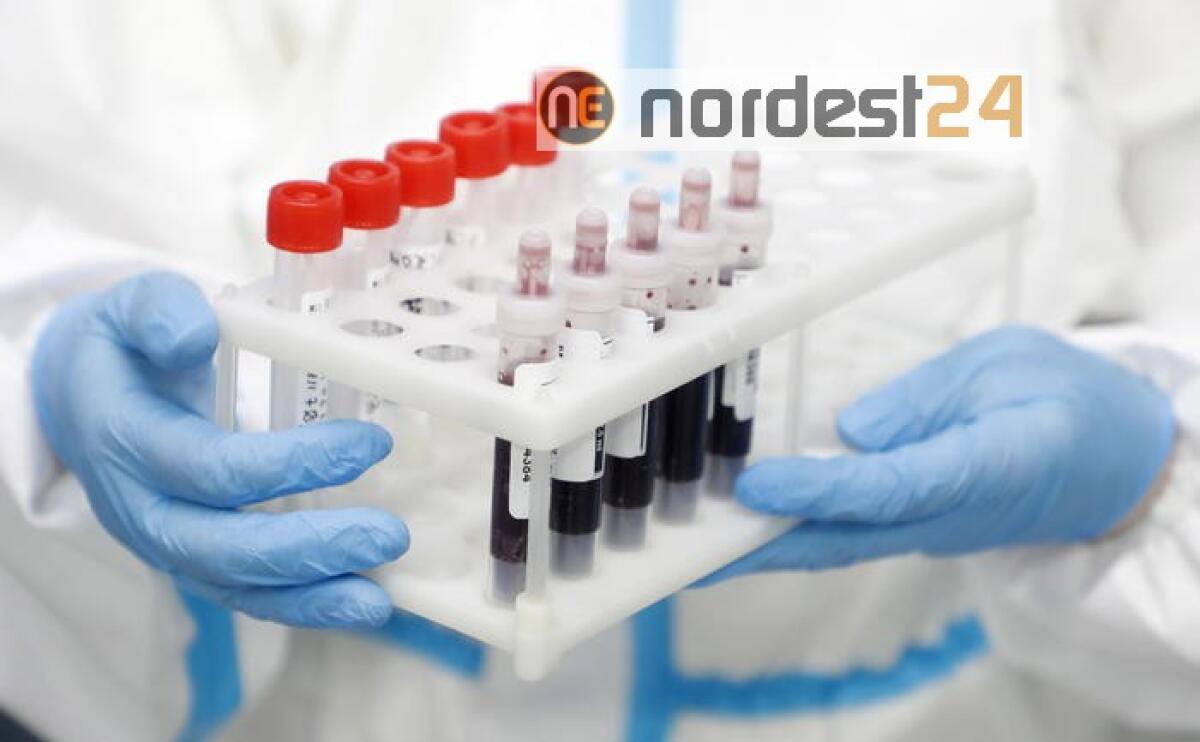 321 contagiati in più,73,8% in Lombardia - 