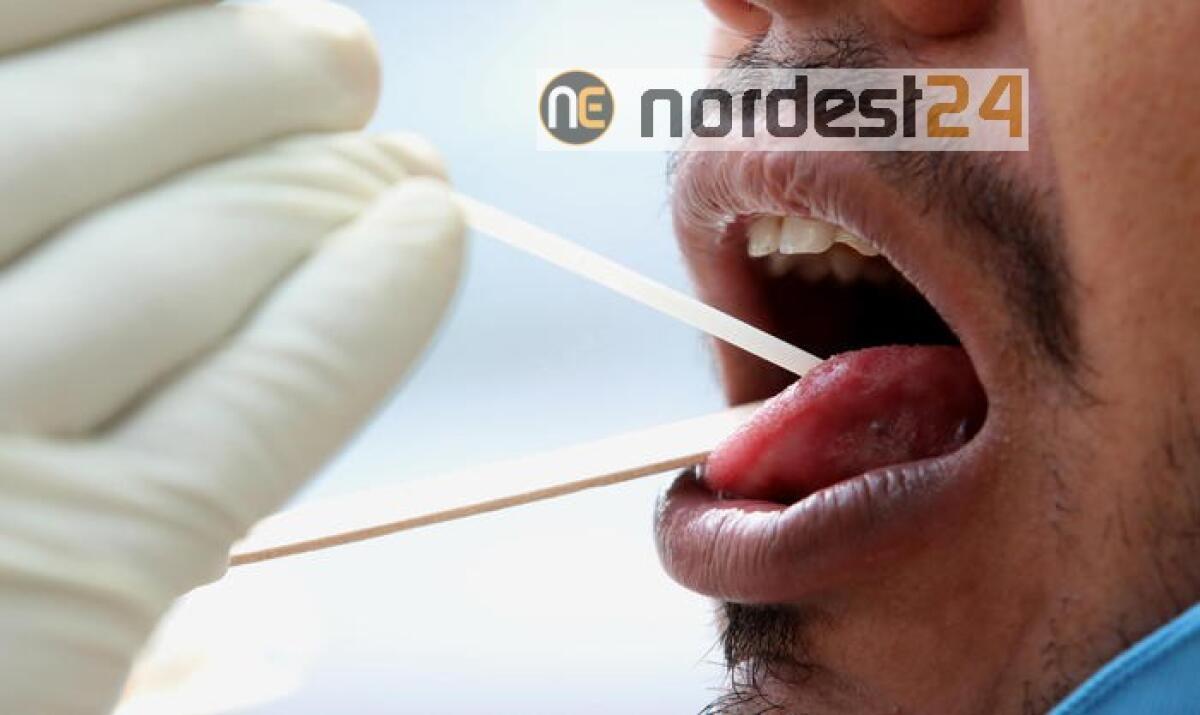 Coronavirus,57.000 casi in Usa in 24 ore - 