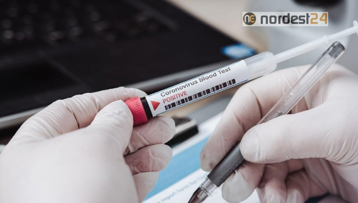 Coronavirus, Fvg: da lunedì test sierologico al personale delle scuole - 