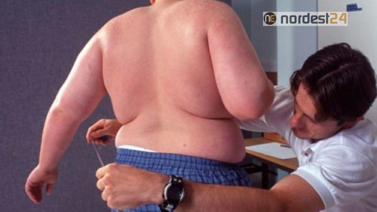 Breda (Oms), "lockdown ha avuto un grave impatto sull'obesità infantile" - 