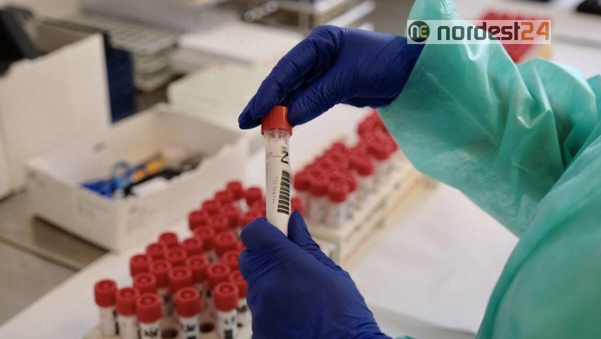 In Fvg 1432 contagi e 15mila tamponi: bollettino del 28 novembre 2020 - 