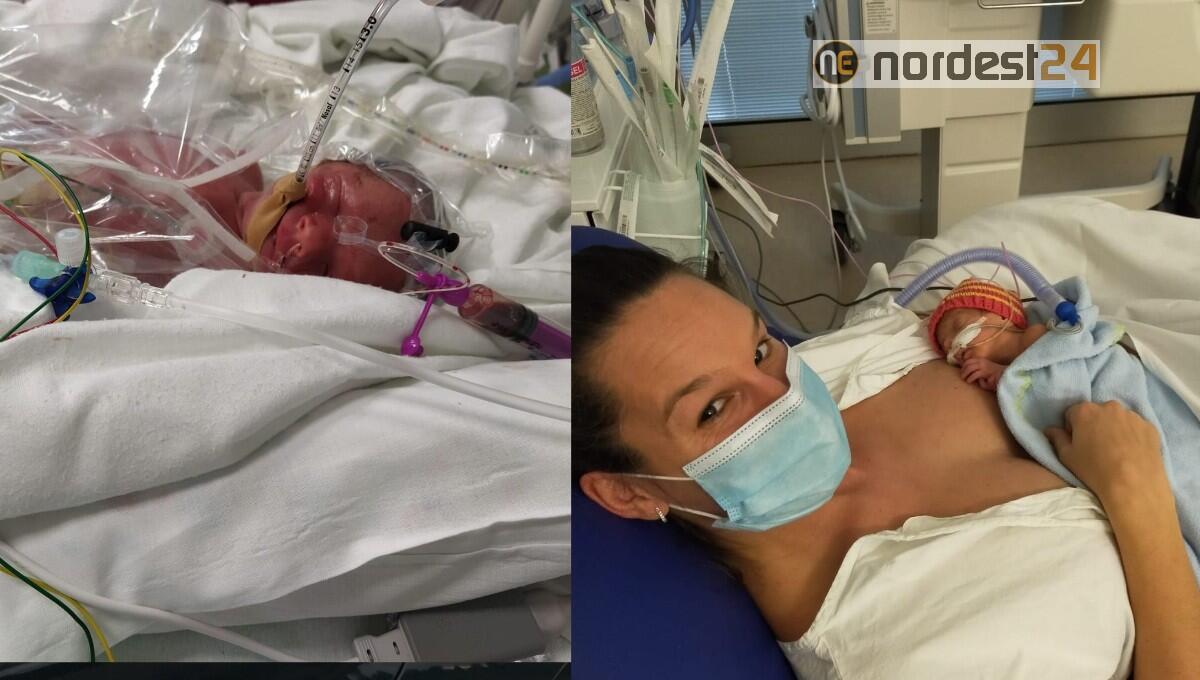 Dopo 2 mesi al Burlo rientrano a casa i gemellini pordenonesi di 29 settimane - 