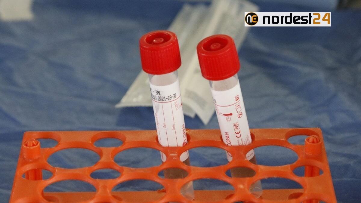 Covid Fvg: 75 casi, 27 ricoveri, 3 persone in terapia intensiva - 