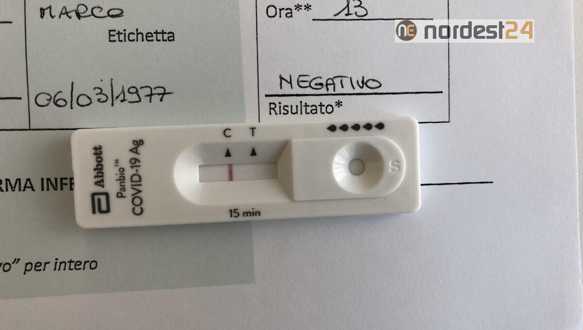 Ulss4, da oggi per i tamponi rapidi è necessaria la prenotazione - 