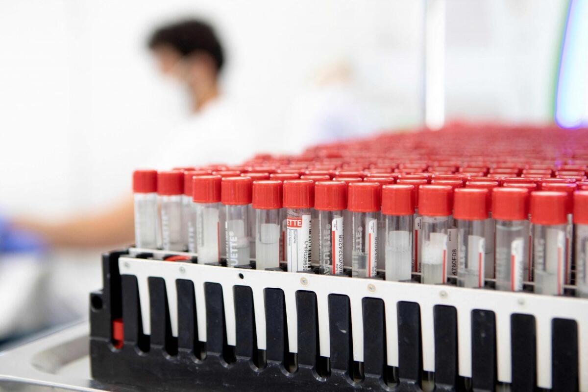 Covid, oggi in Fvg 1.223 nuovi casi e 5 decessi - 