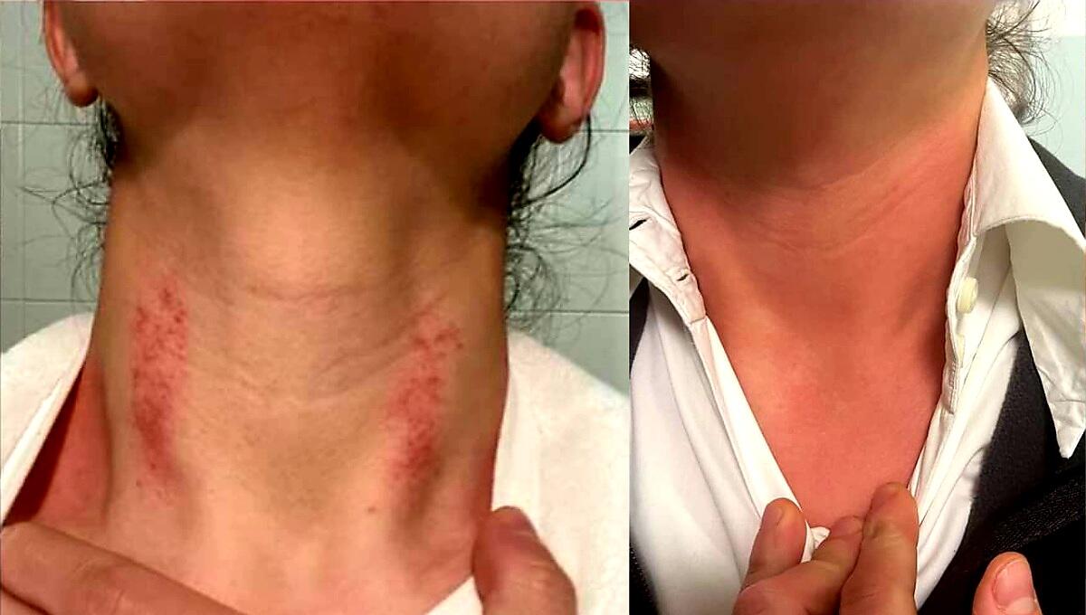 Dottoressa aggredita fuori dalla guardia medica: "presa per il collo, mi voleva strangolare" - 
