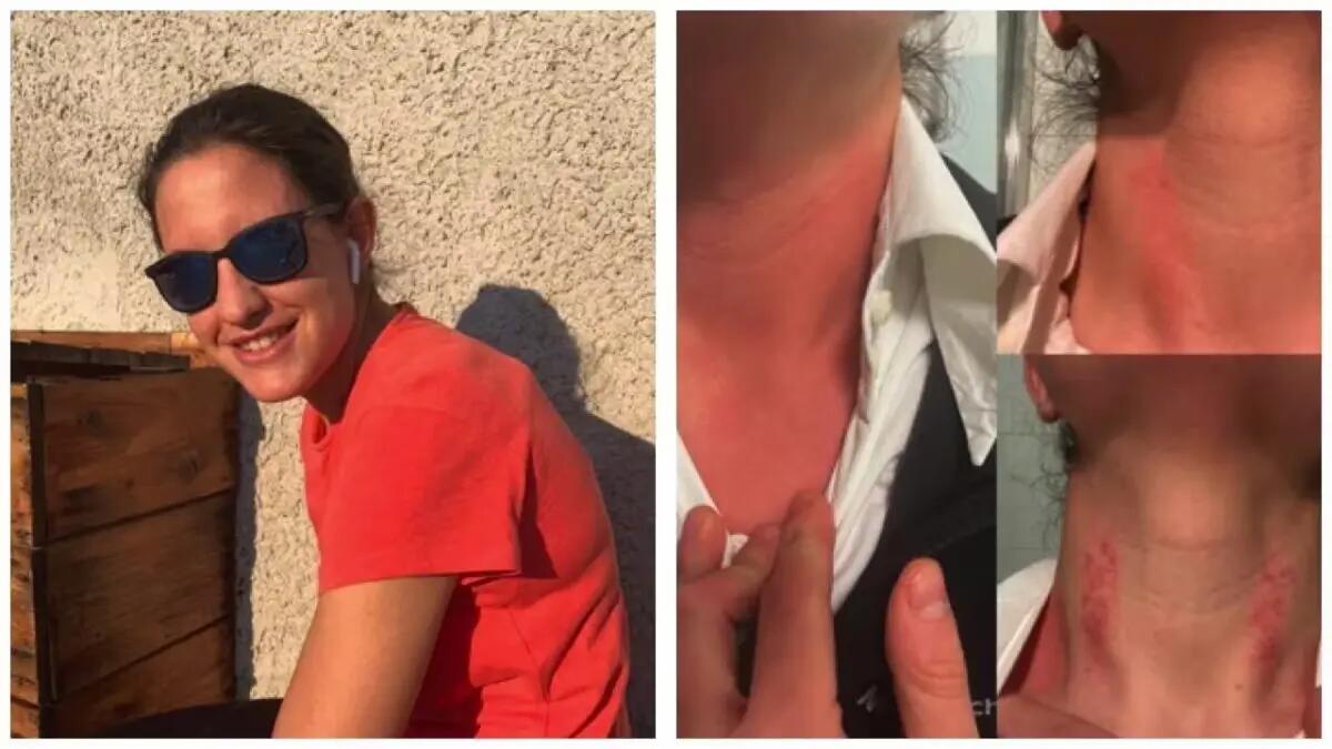 Adelaide Andriani, la dottoressa presa per il collo: «Lascerò la professione medica» - 