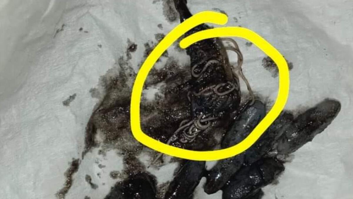 Trieste, vermi nel risotto alle seppie ordinato alla mensa dell’Università - 