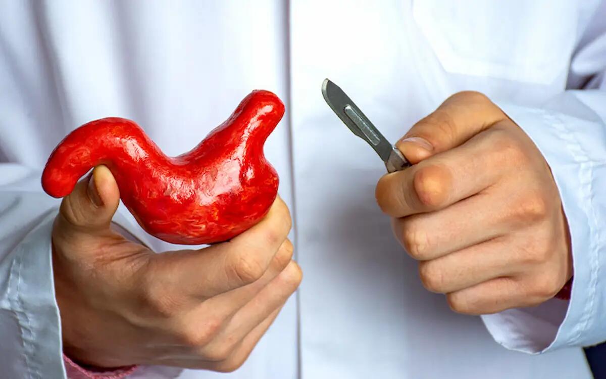 Chirurgia dell’obesità, approvato il percorso diagnostico terapeutico assistenziale (PDTA) - 