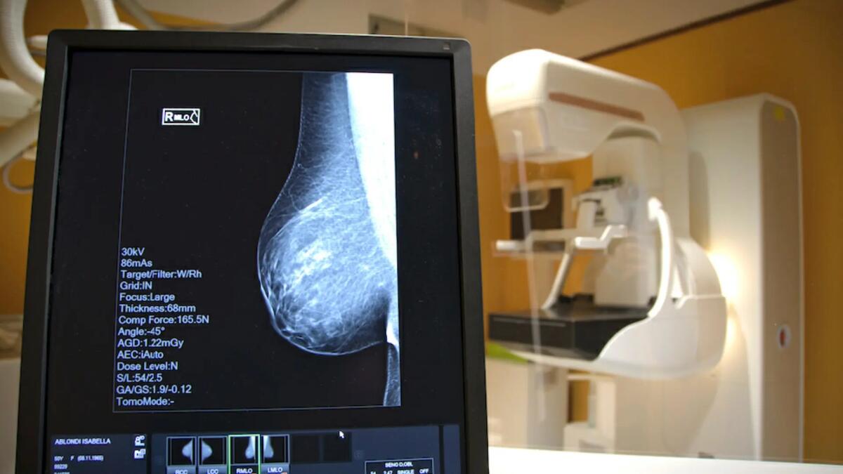 L'Unità senologica di Udine confermata centro europeo di eccellenza - 