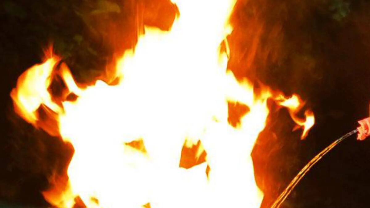 Ustionato al volto da un ritorno di fiamma: grave 20enne - 