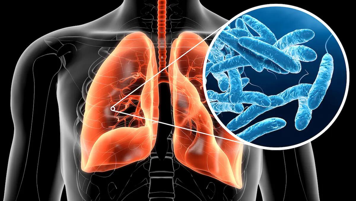 Legionella, diversi i casi nel pordenonese. Un 45enne in terapia intensiva. Dove e come si prende - 