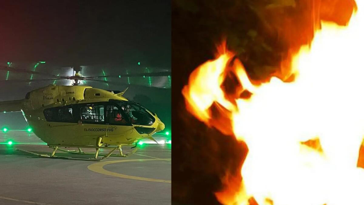 Ritorno di fiamma in casa a Gemona: 42enne ustionato gravemente - 