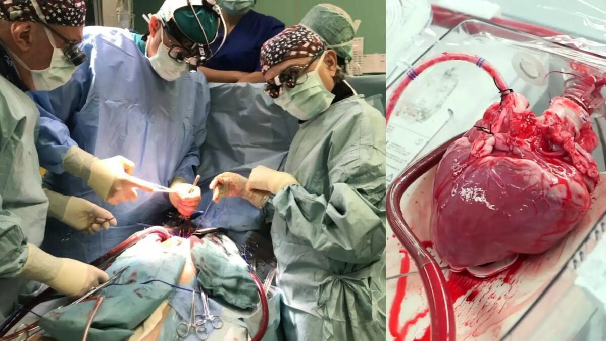 A Padova trapiantato un cuore da persona morta: prima volta al mondo -