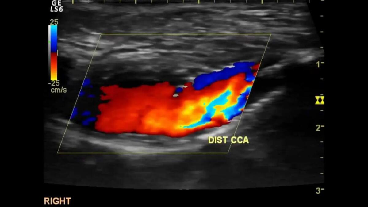 “Doppler day” sabato 14 ottobre negli ospedali di San Donà, Portogruaro e Jesolo - 