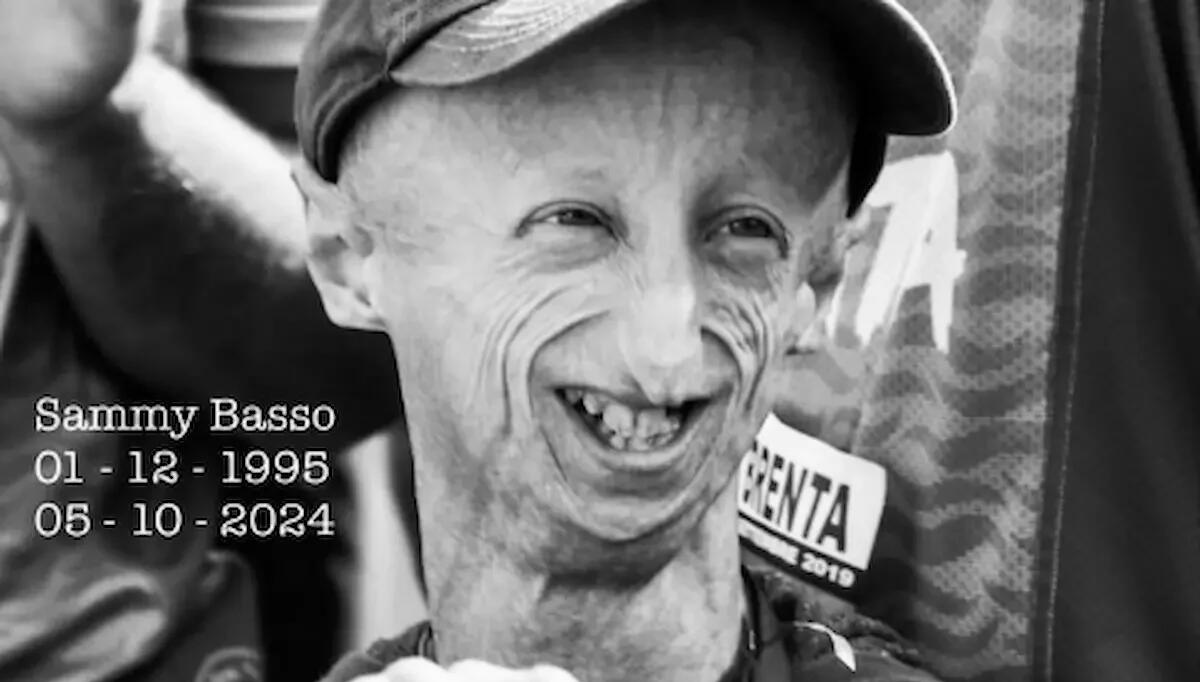 È morto Sammy Basso, aveva 28 anni. Simbolo della lotta contro la Progeria - 