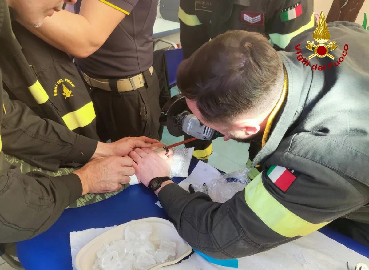 Adolescente in Pronto Soccorso con un anello incastrato al dito: lo tagliano i Vigili del Fuoco -