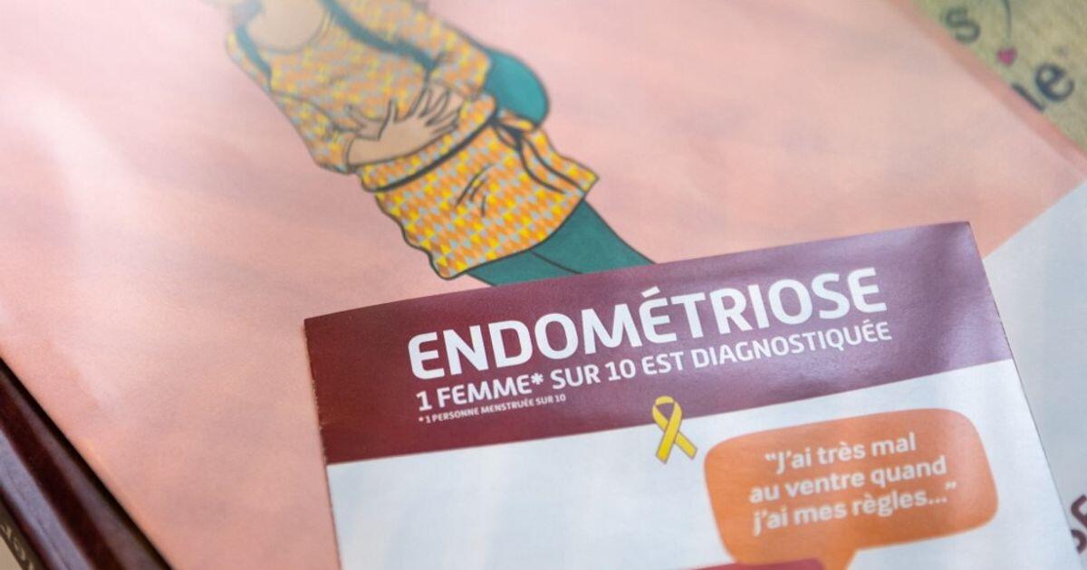 Endometriosi e fibromi: impatto sulla longevità delle donne - 