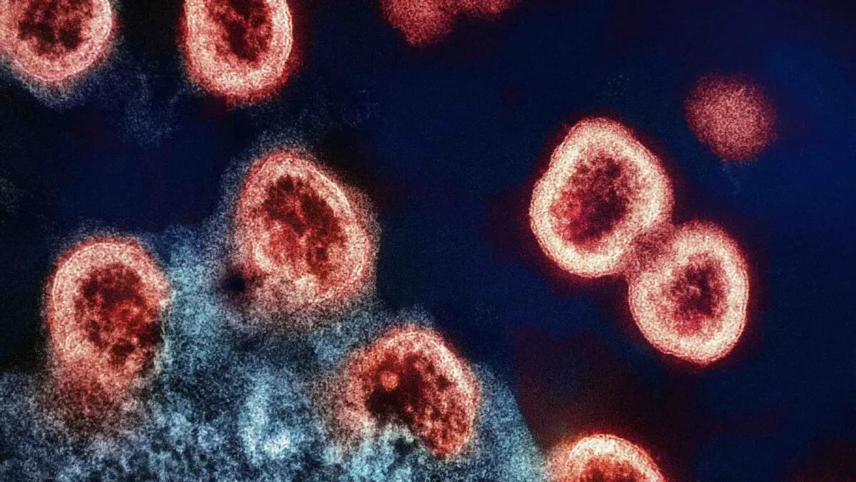 Giornata mondiale contro AIDS e HIV: evento speciale a Trieste - 