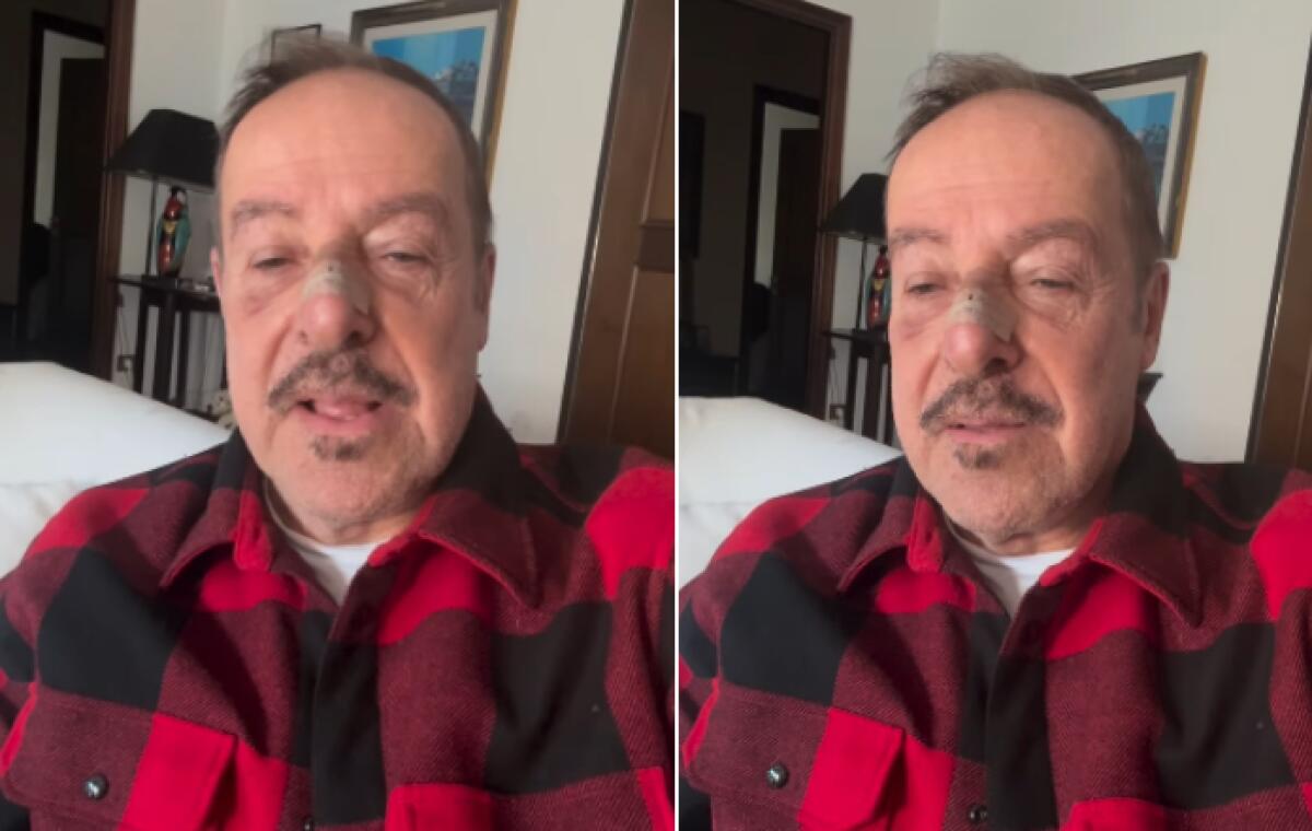 Massimo Lopez investito da una moto pirata a Roma: il video diventa virale sui social - 