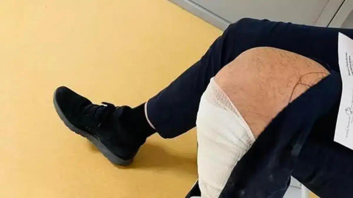 Cerca di aiutare un ubriaco a rialzarsi, ma viene massacrato di botte: autista finisce in ospedale - 