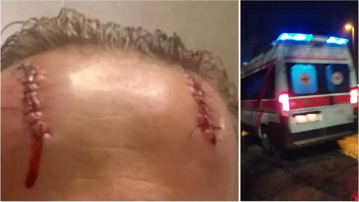 Poliziotta transgender picchiata a sangue da tre ultrà, gli aggressori: "Ti meriti una lezione" - 