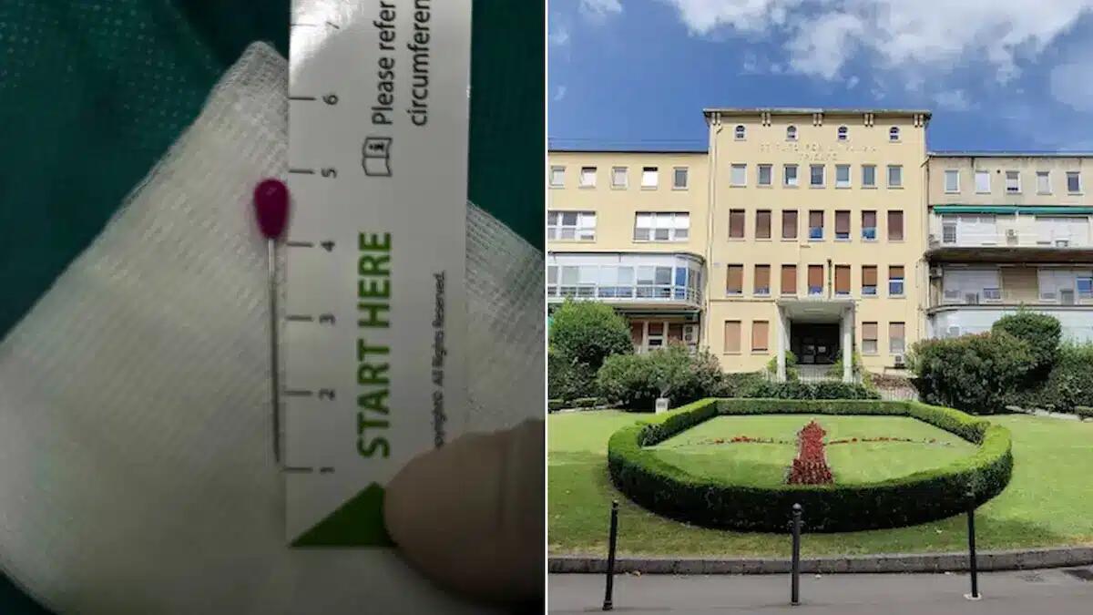Bimba di 18 mesi inala uno spillo e rischia di soffocare: salvata dall’equipe del Burlo di Trieste -