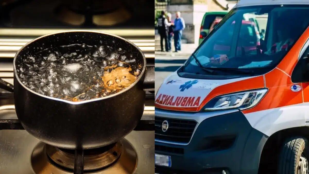 Si rovesciano addosso l'acqua bollente: portati in ospedale due minorenni - 