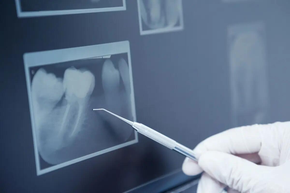 Medicenter: uno studio odontoiatrico di eccellenza a Ronchi dei Legionari - 