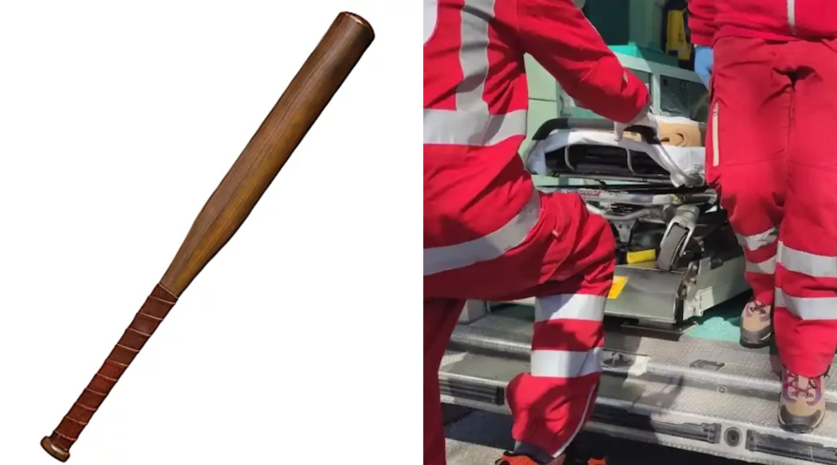 Diverbio stradale finisce nel sangue: 19enne preso a mazzate a Padova - 