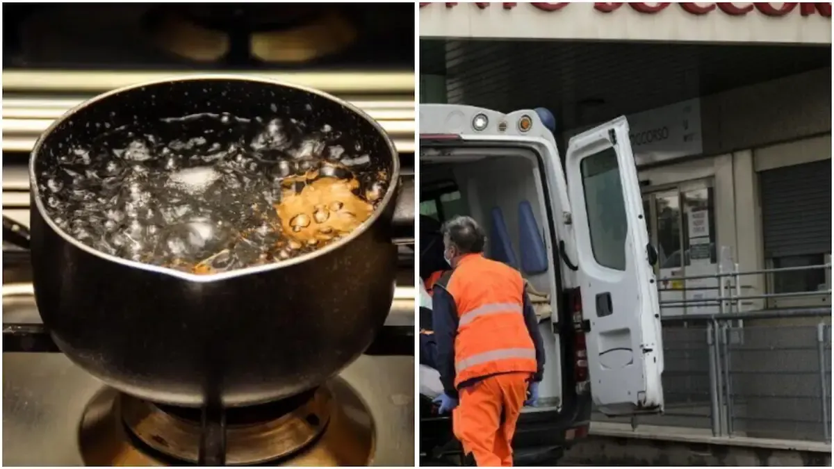 Bimba di 8 anni si rovescia addosso la pentola con l'acqua bollente: ustionata - 