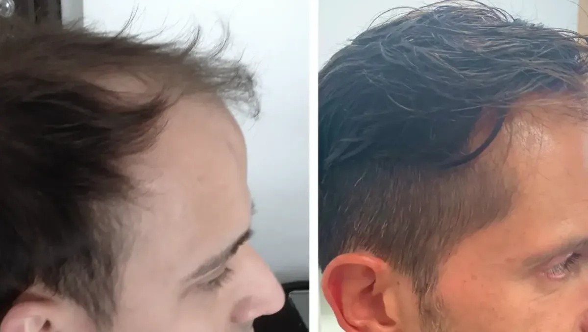 Quando i capelli raccontano chi siamo: scienza, ascolto e fiducia nel percorso di La Clinica Del Capello - 