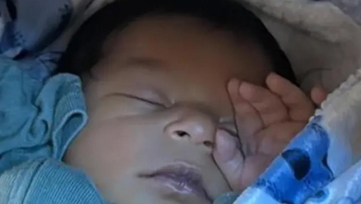 Dal Guatemala per un intervento salvavita: Emmanuel muore a 49 giorni all'ospedale di Padova - 