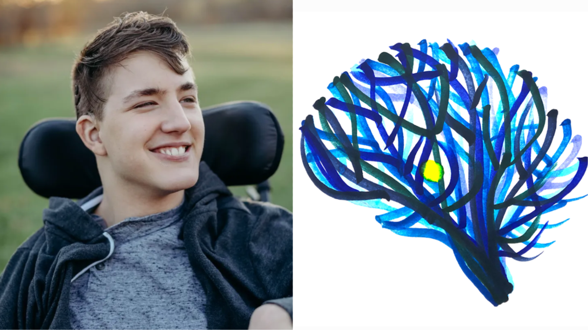 Trieste, progetto Blue: una ricerca unica al mondo sulle conseguenze neurologiche della bilirubina - 