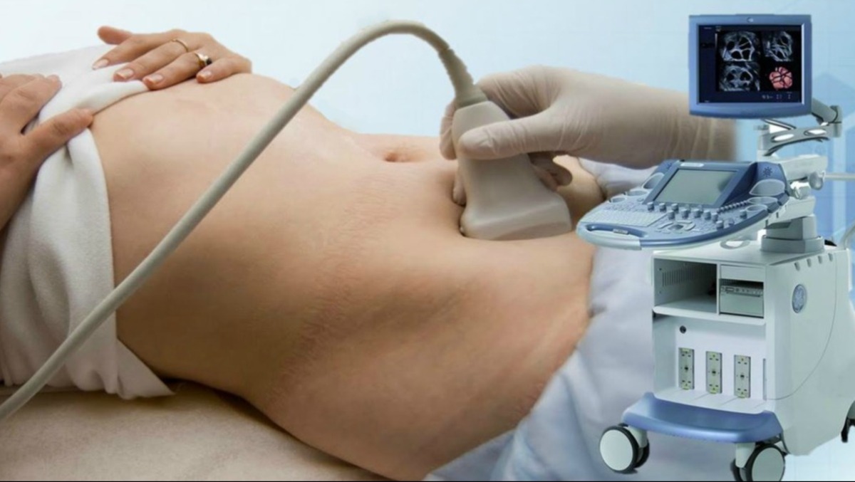 Tumore ovarico, prima piattaforma IA in FVG per ridurre le diagnosi tardive: ecco OvAi - 