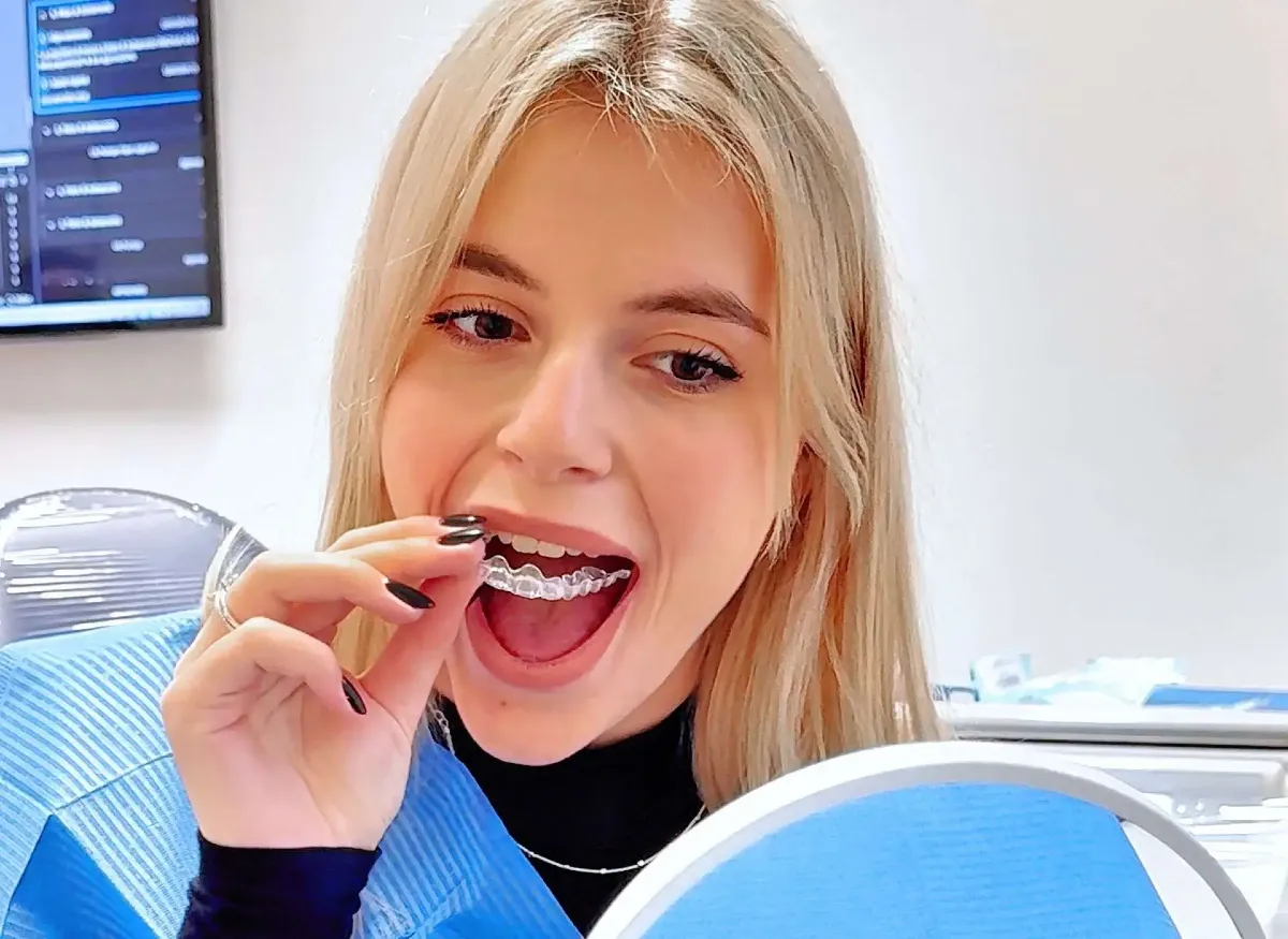 Apparecchio trasparente a Verona: tempi, metodo e quotidianità del trattamento - 