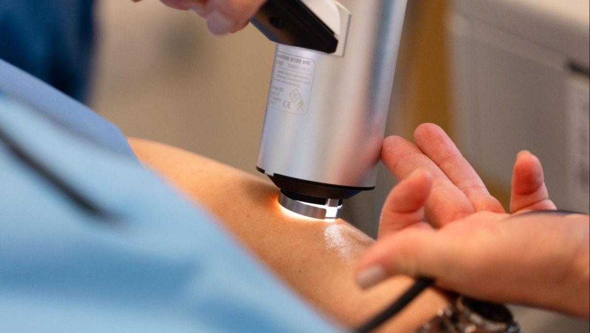 CRO di Aviano, ricerca sul melanoma: crescono guarigioni e aspettativa di vita - 