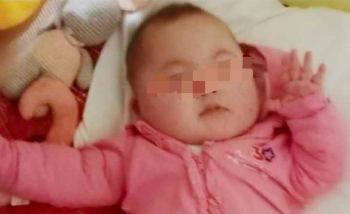 L'intervento e la tragedia: Giada muore poco prima di compiere un anno - 