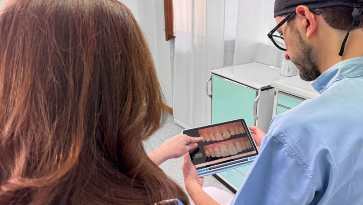 Faccette dentali a Castelgomberto: come cambiano i denti e cosa sapere prima di sceglierle - 