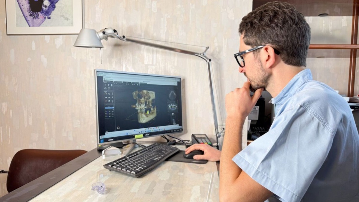 Impianto dentale a Castelgomberto: le tecniche più utilizzate oggi nell'implantologia dentale - 