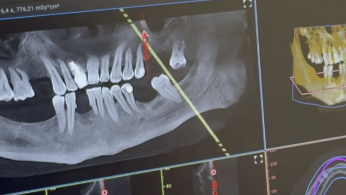 Guidonia Montecelio e odontoiatria digitale: come la tecnologia può rendere più comprensibile il percorso di cura - 